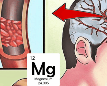 13 Silent Signs You’re Dangerously Low on Magnesium – And Exactly How to Fix It Fast!